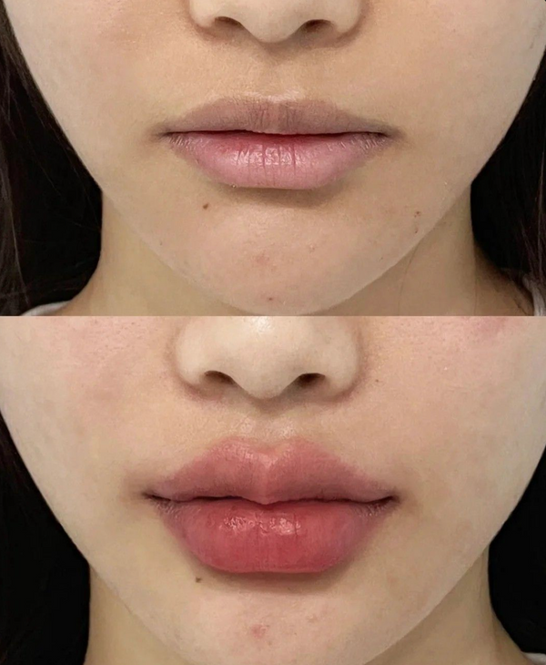 Weitere Kundenergebnisse🩷