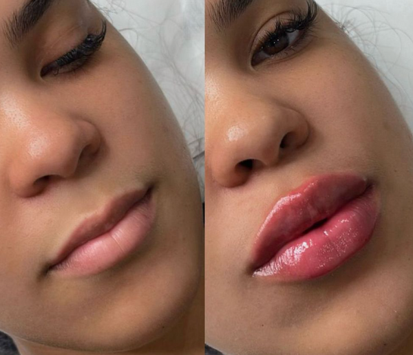 Weitere Kundenergebnisse🩷