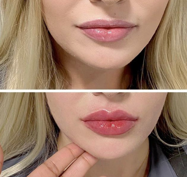 Weitere Kundenergebnisse🩷