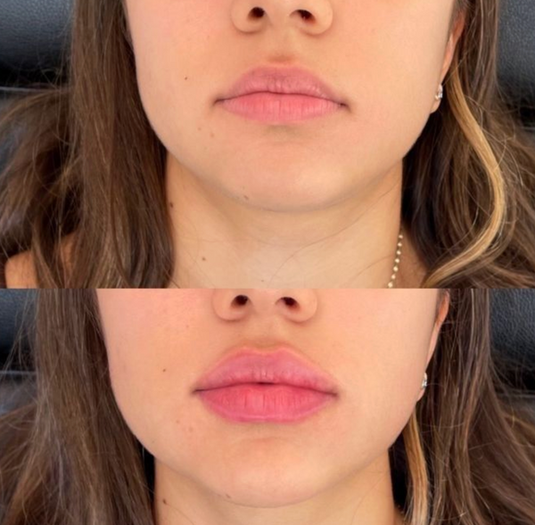 Weitere Kundenergebnisse🩷