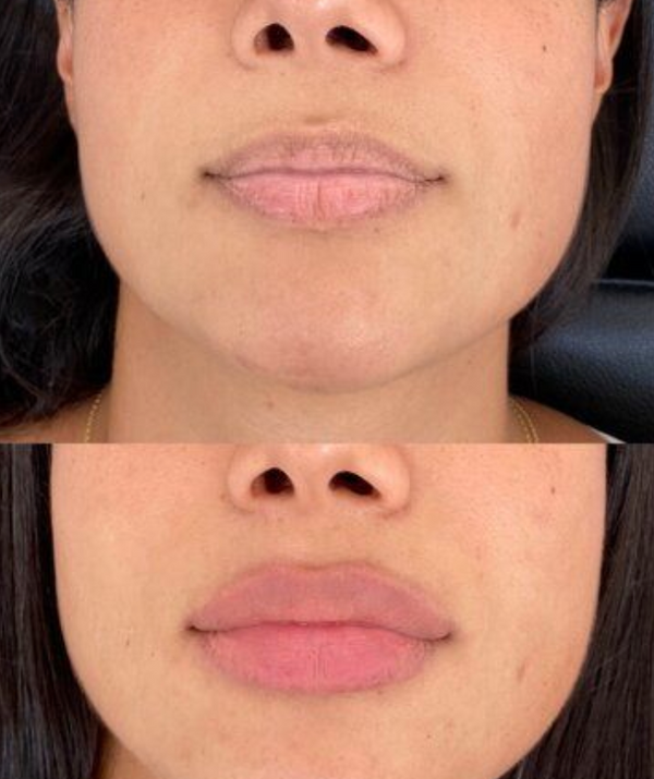 Weitere Kundenergebnisse🩷