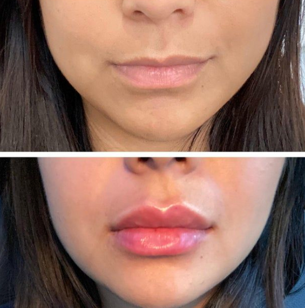 Weitere Kundenergebnisse🩷