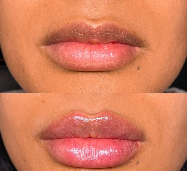 Weitere Kundenergebnisse🩷